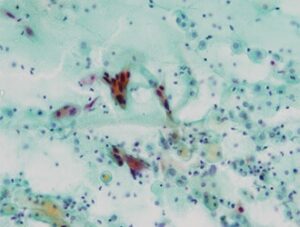 病理(組織診・細胞診)