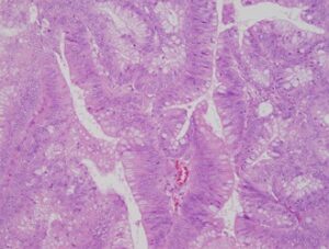 病理(組織診・細胞診)